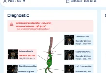 Nurea wins FDA clearance for PRAEVAorta® 2 software Nurea wins FDA clearance for PRAEVAorta® 2 software