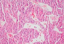 ABK Biomedical raises $35 million in Series D financing ABK Biomedical raises $35 million in Series D financing