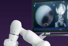 Noah Medical reports positive robotic bronchoscopy data Noah Medical reports positive robotic bronchoscopy data