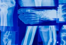 CustoMED raised $6M to scale AI 3D printed solutions for orthopedic surgery CustoMED raised $6M to scale AI 3D printed solutions for orthopedic surgery