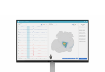 Vektor Medical wins CE mark for AI-based arrhythmia mapping system Vektor Medical wins CE mark for AI-based arrhythmia mapping system