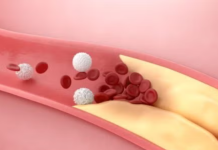 VentureMed raises $29m for vessel prep system advancement VentureMed raises $29m for vessel prep system advancement