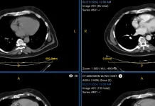 FDA grants 510(k) clearance to Sirona Medical’s imaging suite FDA grants 510(k) clearance to Sirona Medical’s imaging suite