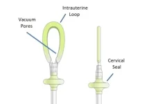 Organon divests JADA system to Laborie in $465m deal Organon divests JADA system to Laborie in $465m deal