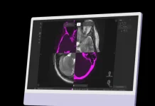 FDA and EU clear Zap Surgical’s radiosurgery planning system FDA and EU clear Zap Surgical’s radiosurgery planning system