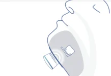 Nyxoah raises $77M to support Genio sleep apnea neuromod rollout Nyxoah raises $77M to support Genio sleep apnea neuromod rollout