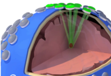 Cordance Medical raises $8M seed for focused ultrasound used in brain treatment Cordance Medical raises $8M seed for focused ultrasound used in brain treatment