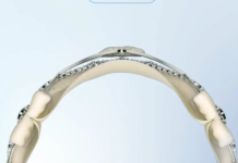 JenaValve reports positive Trilogy heart valve data for aortic regurgitation JenaValve reports positive Trilogy heart valve data for aortic regurgitation