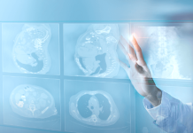 Nanox announces $15M registered direct offering of common stock Nanox announces $15M registered direct offering of common stock