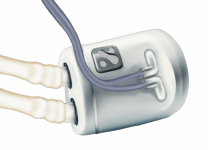 Nephrodite’s continuous dialysis implant wins FDA breakthrough device designation Nephrodite’s continuous dialysis implant wins FDA breakthrough device designation