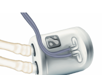 Nephrodite’s continuous dialysis implant wins FDA breakthrough device designation Nephrodite’s continuous dialysis implant wins FDA breakthrough device designation