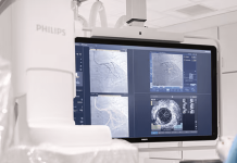 Philips doubles down on image-guided therapy with SpectraWAVE acquisition Philips doubles down on image-guided therapy with SpectraWAVE acquisition