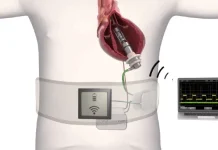 FineHeart secures additional €35M to support its growth FineHeart secures additional €35M to support its growth