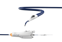 Inquis Medical announces $75M Series C financing to scale AVENTUS Inquis Medical announces $75M Series C financing to scale AVENTUS