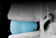 Spineology launches innovative patient-specific spinal implant Spineology launches innovative patient-specific spinal implant