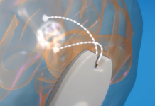 CraniUS closes $20M financing to support blood-brain barrier tech for drug delivery CraniUS closes $20M financing to support blood-brain barrier tech for drug delivery