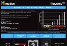 Median Technologies receives FDA 510(k) clearance for eyonis LCS, an AI-based detection and diagnosis device for lung cancer screening Median Technologies receives FDA 510(k) clearance for eyonis LCS, an AI-based detection and diagnosis device for lung cancer screening