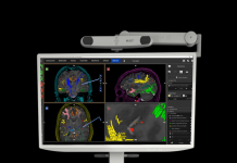 Synaptive Medical’s latest version of Modus Nav receives CE mark Synaptive Medical's latest version of Modus Nav receives CE mark