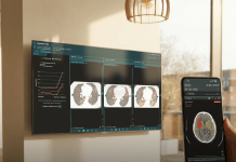 Brainomix extends Series C financing to $25.4M to support U.S. expansion Brainomix extends Series C financing to $25.4M to support U.S. expansion