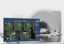 Monteris Medical raises $28M Series E for robotic neurosurgery tech Monteris Medical raises $28M Series E for robotic neurosurgery tech