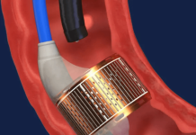 Endogenex raises $50M to advance type 2 diabetes treatment Endogenex raises $50M to advance type 2 diabetes treatment