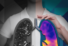 4DMedical receives CE Mark for CT:VQ, enabling EU launch 4DMedical receives CE Mark for CT:VQ, enabling commercial launch across the EU