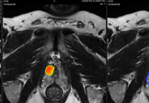 Lucida Medical raises £8.7M to power ‘same day’ cancer diagnosis Lucida Medical raises £8.7M to power ‘same day’ cancer diagnosis