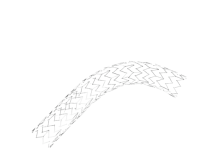 Serenity Medical earns FDA HDE for cerebral venous stent Serenity Medical earns FDA HDE for cerebral venous stent