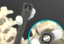 FDA grants 510(k) clearance for Allevion Medical’s Vantage system FDA grants 510(k) clearance for Allevion Medical’s Vantage system