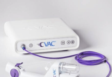 Calyxo raises $40M for kidney stone removal system Calyxo raises $40M for kidney stone removal system