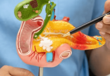 Sonire Therapeutics raises $18M for tumour ablation platform advancement Sonire Therapeutics raises $18M for tumour ablation platform advancement