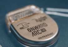 ONWARD Medical raises over €40M in capital increase ONWARD Medical raises over €40M in capital increase