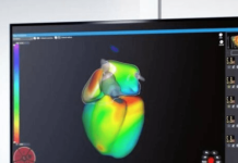 Corify Care picks up FDA nod for cardiac mapping tech Corify Care picks up FDA nod for cardiac mapping tech