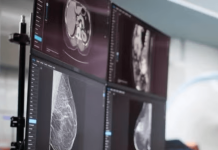 ScreenPoint Medical raises $16M with continued investment from Siemens Healthineers ScreenPoint Medical raises $16M with continued investment from Siemens Healthineers