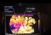 Hypervision raises $23M Series A for hyperspectral surgical imaging tech Hypervision raises $23M Series A for hyperspectral surgical imaging tech