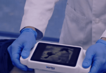 Vortex Imaging secures $12M for 3D imaging expansion Vortex Imaging secures $12M for 3D imaging expansion