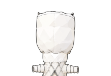 Veritas Aortic Solutions raises $12M for aortic disease treatment advance Veritas Aortic Solutions raises $12M for aortic disease treatment advance