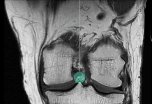 Subtle Medical raises $33M to advance AI image software Subtle Medical raises $33M to advance AI image software