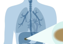 Petal Surgical adds more funding for incisionless surgical robot Petal Surgical adds more funding for incisionless surgical robot