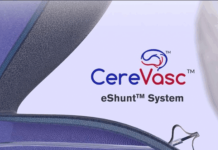 CereVasc closes $85M Series C to support eShunt system CereVasc closes $85M Series C to support eShunt system