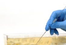 Neuronoff implants first patient in DOD-funded trial of Injectrode Neuronoff implants first patient in DOD-Funded trial of Injectrode
