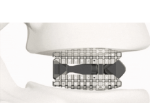 Xenix Medical announces FDA clearance and full commercial launch of the Lux System Xenix Medical announces FDA clearance and full commercial launch of the Lux System