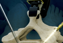 LEM Surgical wins new FDA clearance for humanoid surgical robot LEM Surgical wins new FDA clearance for humanoid surgical robot