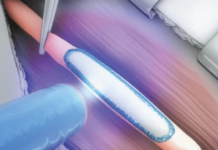 Tissium closes $68M financing for tissue reconstruction polymers Tissium closes $68M financing for tissue reconstruction polymers