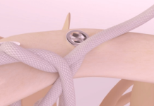 Movmedix gets FDA nod for third-gen synthetic shoulder implant Movmedix gets FDA nod for third-gen synthetic shoulder implant